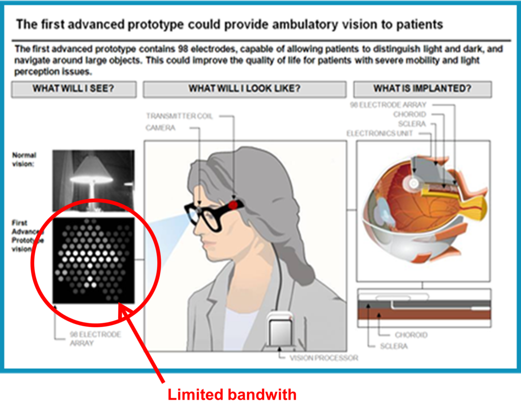 Diagram outlining bionic eye prototype