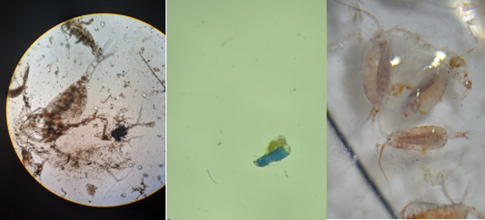 Zooplankton - Calanoid (copepods) and a piece of plastic in the centre