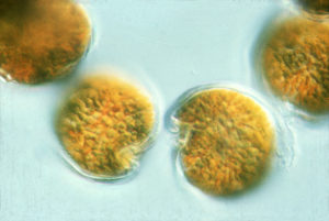 Yellow spots which are single cells of micro-algae as seen under a microscope.