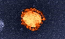 Coronaviruses